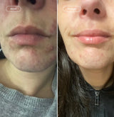 Gel limpiador facial