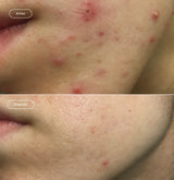 Sebum balance sérum