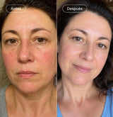 Pack "Green beauty" Face™