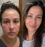 Pack "Green beauty" Face™