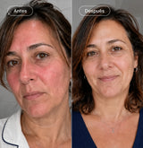 Crema facial hidratante y calmante