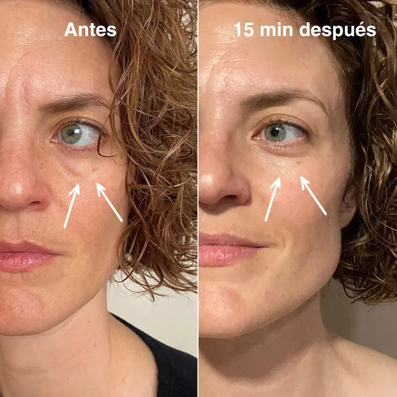 Roll-on eye serum