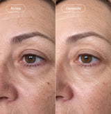 Pack "Essential" Radiance