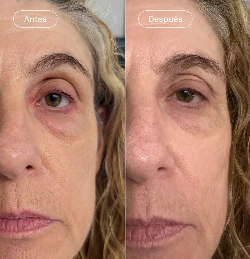 Roll-on eye serum