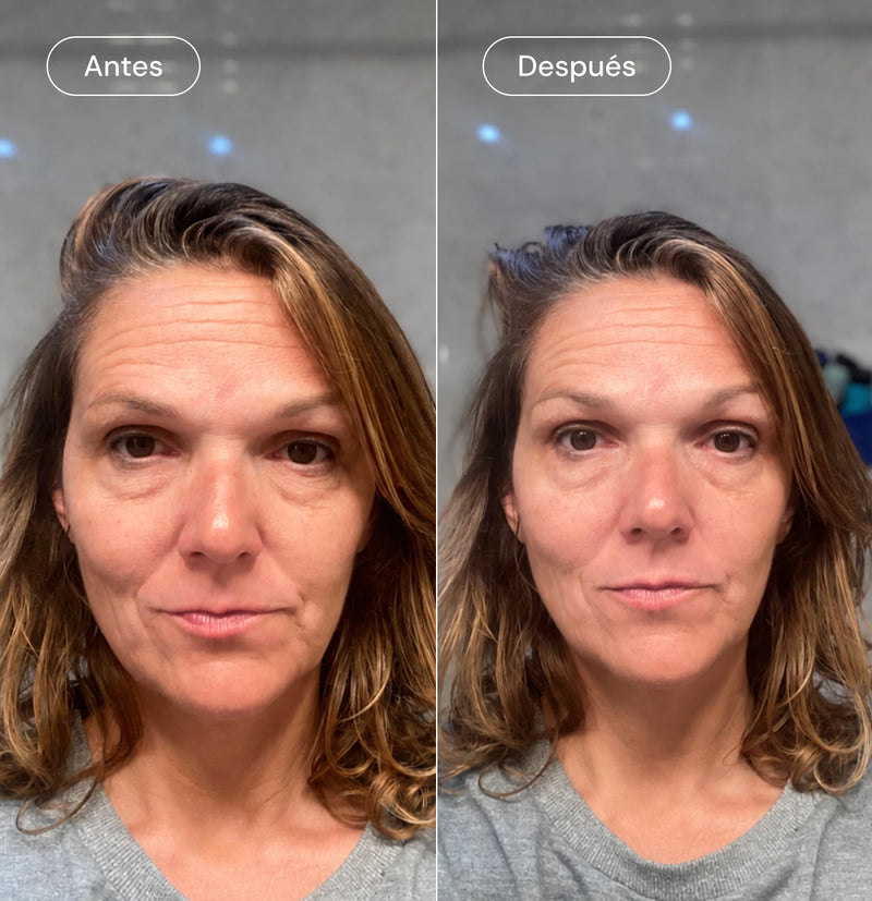 Roll-on eye serum