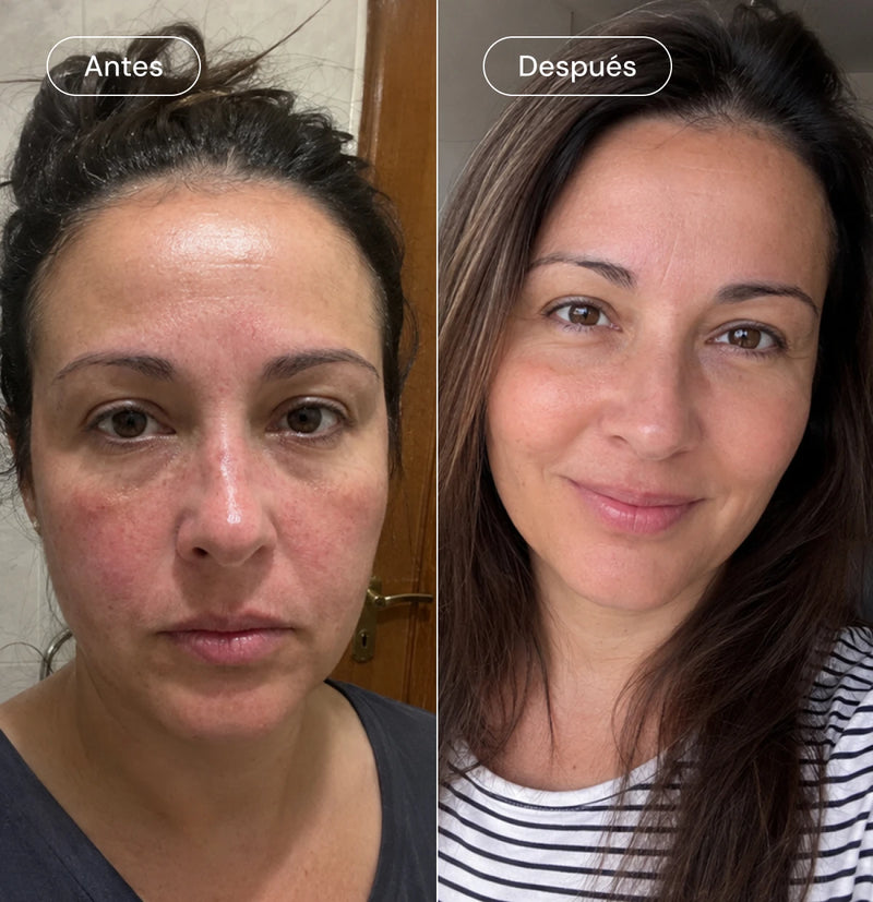 Pack "Green beauty" Face™