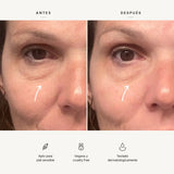 Roll-on eye serum