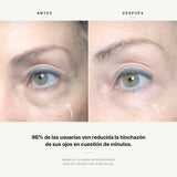 Roll-on eye serum